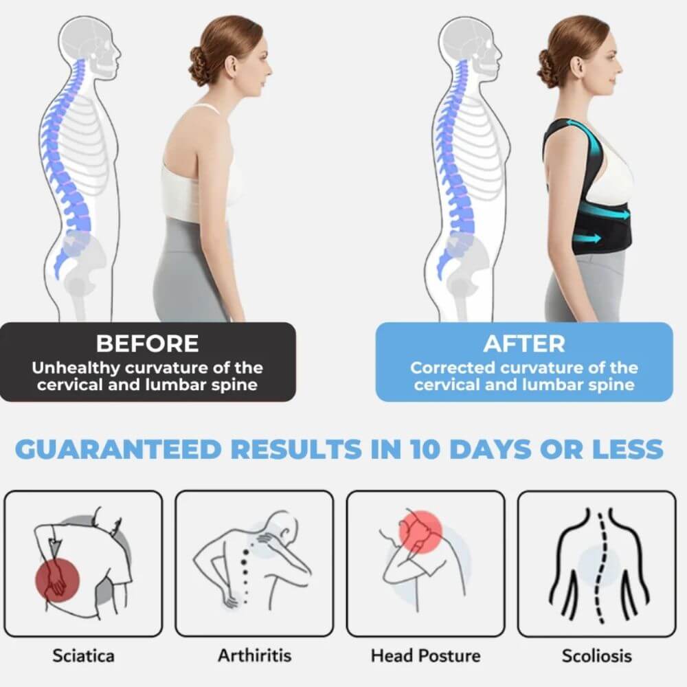 Posture corrector results showing spinal alignment improvement for cervical and lumbar curvature